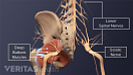The lower back and pelvis highlghting the deep pelvic muscles, lumbar spinal nerves, and the sciatic nerve.