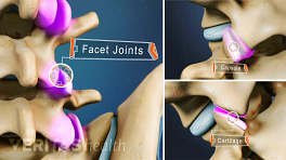 Three views of facet joints