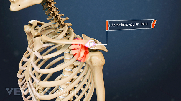 Medical illustration showing the acromioclavicular joint