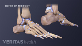 足部骨骼的侧面和内侧视图。