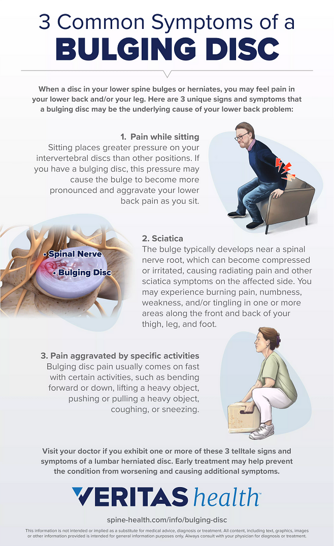Infographic of 3 Common Symptoms of a Bulging Disc