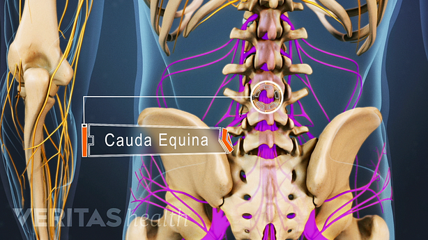 Posterior view of the lower back showing cauda equina in the lumbar spine.