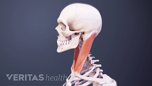 Vista de perfil del cráneo y la parte superior del cuerpo que muestra los músculos cervicales.
