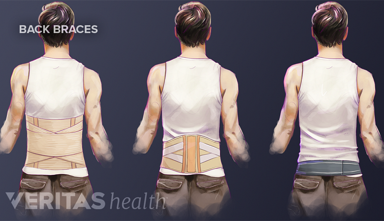Different types of back braces and lumbosacral braces.