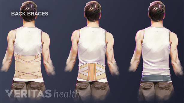 Illustration of corset, lumbar belt, and sacroiliac belt flexible braces for lower back pain