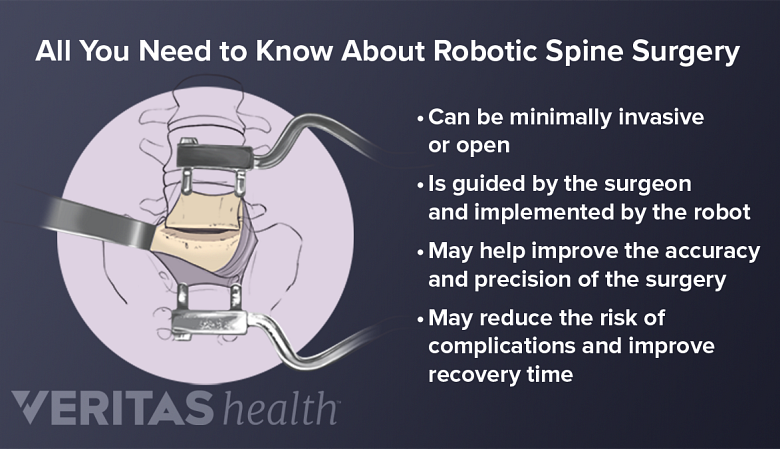 All You Need to Know About Robotic Spine Surgery
