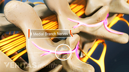 Medial branch nerves coming out between the vertebrae.