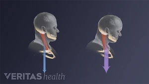 Natural head posture (A) and comfortable maximum forward head posture