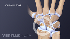Carpal bones of the hand and wrist