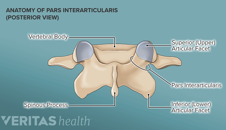 Illustration showing anatomy of pars intercularis.