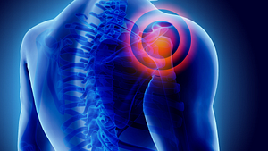 Posterior view of a back with red circles radiating from the shoulder indicating pain