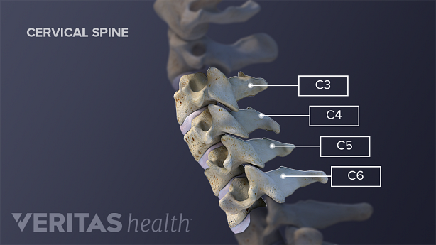 Profile view of C3, C4, C5, and C6 cervical vertebrae.