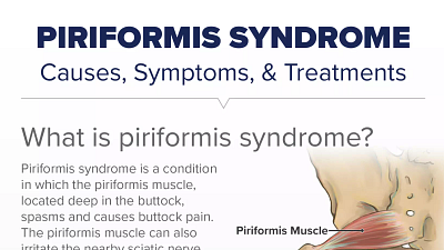 Piriformis Syndrome Treatment At Home - Symptoms, Causes, Stretches