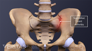 3D rendering of the hip bone of the human skeleton. Highlighting the SI Joint.