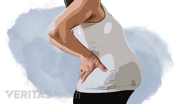 Pregnant woman with back ache.