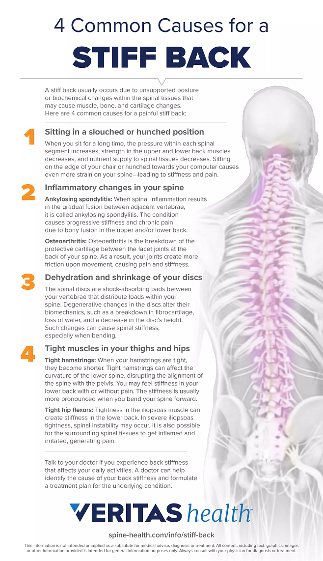 4 Common Causes of a Stiff Back Infographic