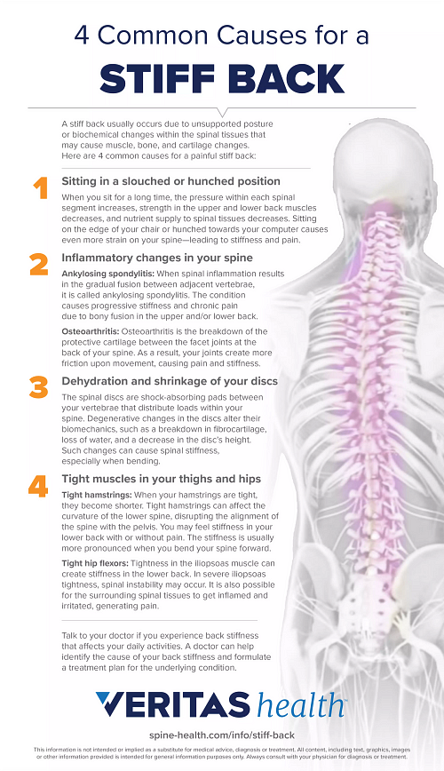 Infographic of 4 Common Causes of Stiff Back