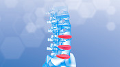 Anterior view of a lumbar spine highlighting the disc spaces.