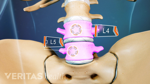 Anterior view of the lumbar spine labeling L4, and L5.