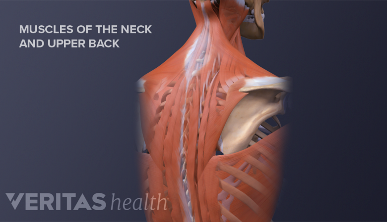 3D image of the neck and upper back muscles.
