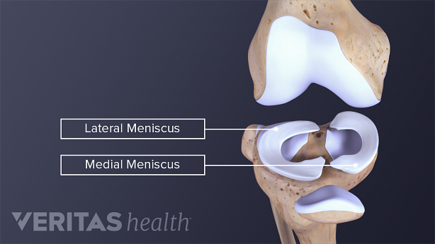 View of the lateral and medial menisci