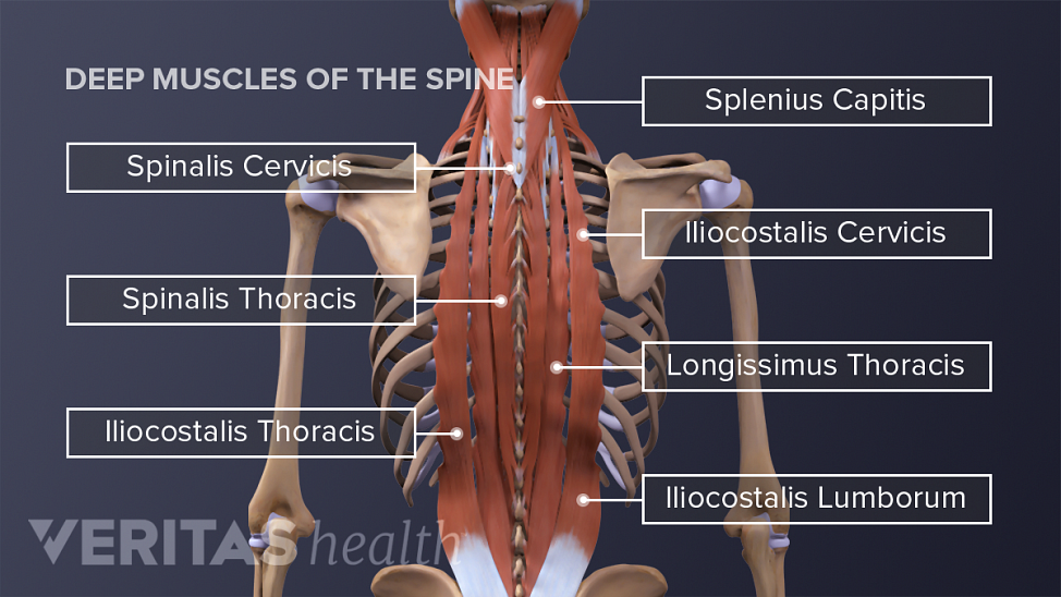Posterior view of spine muscles labeling iliocostalis cervicis, longissimus thoracis, splenius capitis, spinalis cervicis, spinalis thoracis, iliocostalis thoracis, iliocostalis lumborum