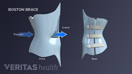 Low Back Pain Relief Back Brace - Derma Roller Systems SA