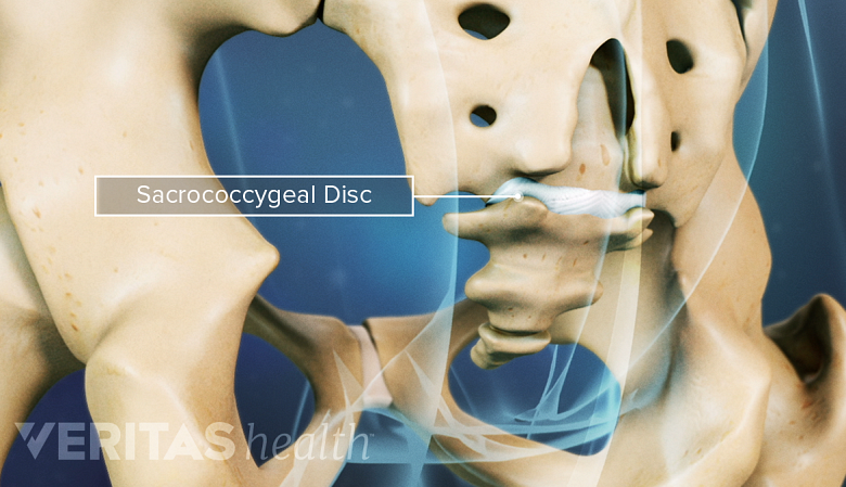 An illustration of sacrococcygeal disc in white.