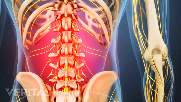 An illustration showing an adult spine with low back muscles highlighted in red.