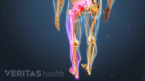 3D rendering of the lower body. Nerves of left leg highlighted in red and pink.