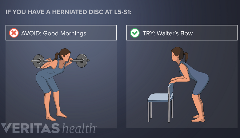 Avoid Good Mornings with lower back or L5-S1 disc herniation. Try Waiters Bow.