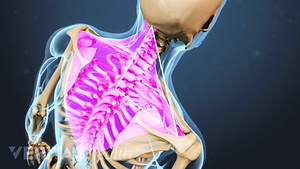 Posterior view of the upper body showing pain in the neck and shoulders.