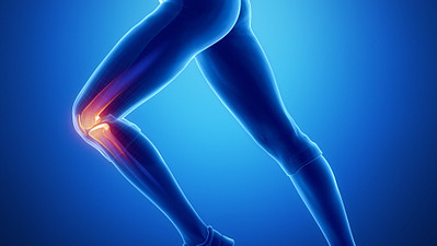 一个女人跑步的剪影，她的膝盖用红色突出显示，表明疼痛