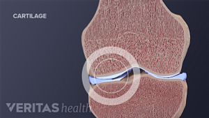 Skeletal view of normal knee cartilage