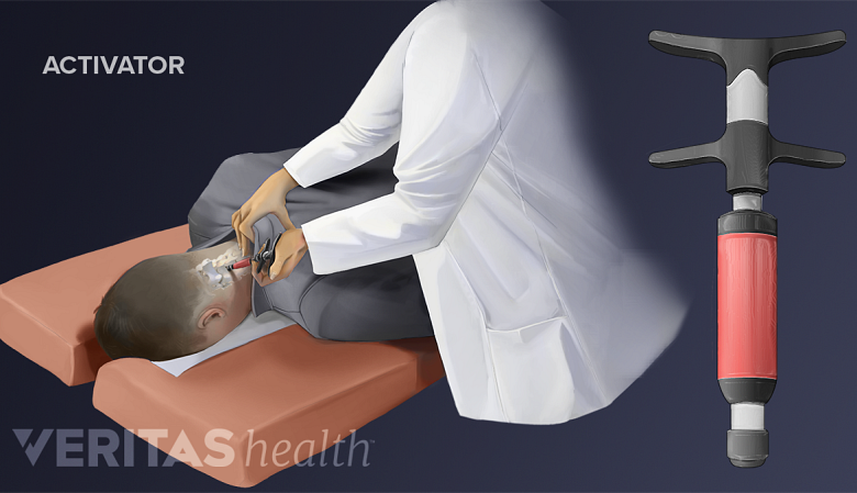 Illustration showing a coctor using a activator device.