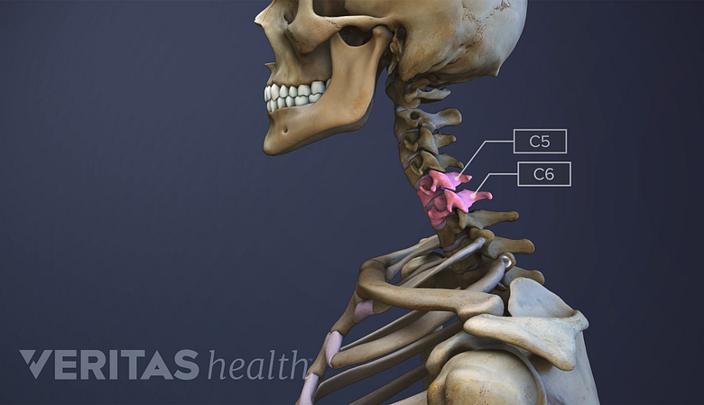 Illustration showing a skull with cervical vertebrae C5-C6 highlighted in pink.