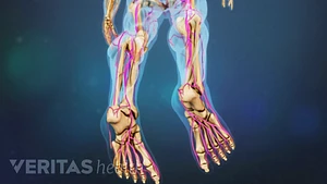 Understanding Foot Drop: Symptoms, Causes, and Effective Treatments  Best  Back Pain, Slip Disc, Knee Arthritis, Sciatica Treatment in Aundh Pune