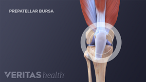 Medical illustration of a prepatellar knee bursa