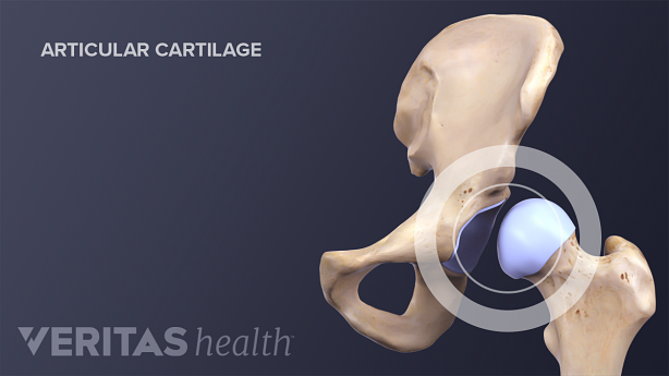 Illustration of hip articular cartilage