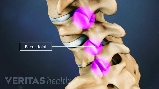 Facet joints in the lower back.