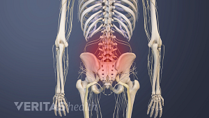 Posterior view of pain in the lumbar spine