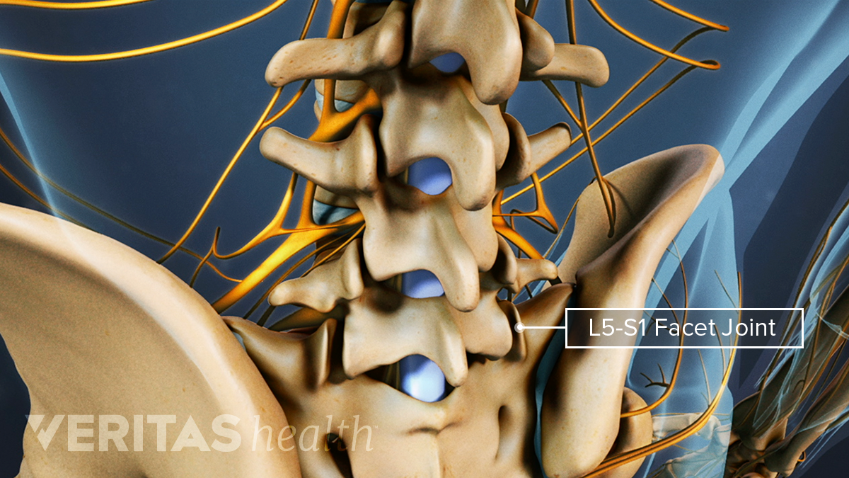 All About L5-S1 (Lumbosacral Joint) | Spine-health