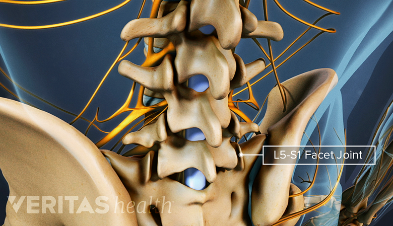 Posterior 3D view of the lumbar spine with the L5-S1 facet joints labeled.