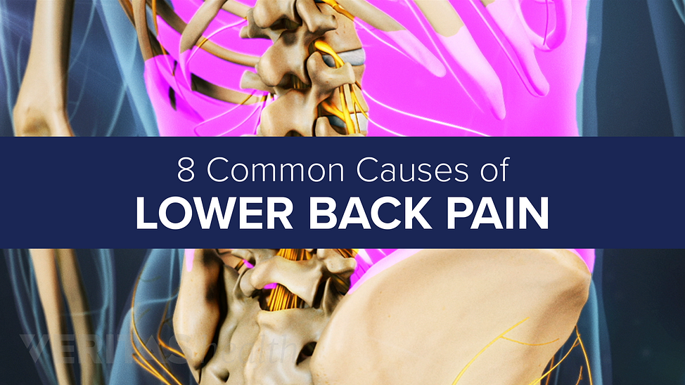 Animated still highlighting the location of the lower back muscles with the title 8 common causes of back pain overlaid