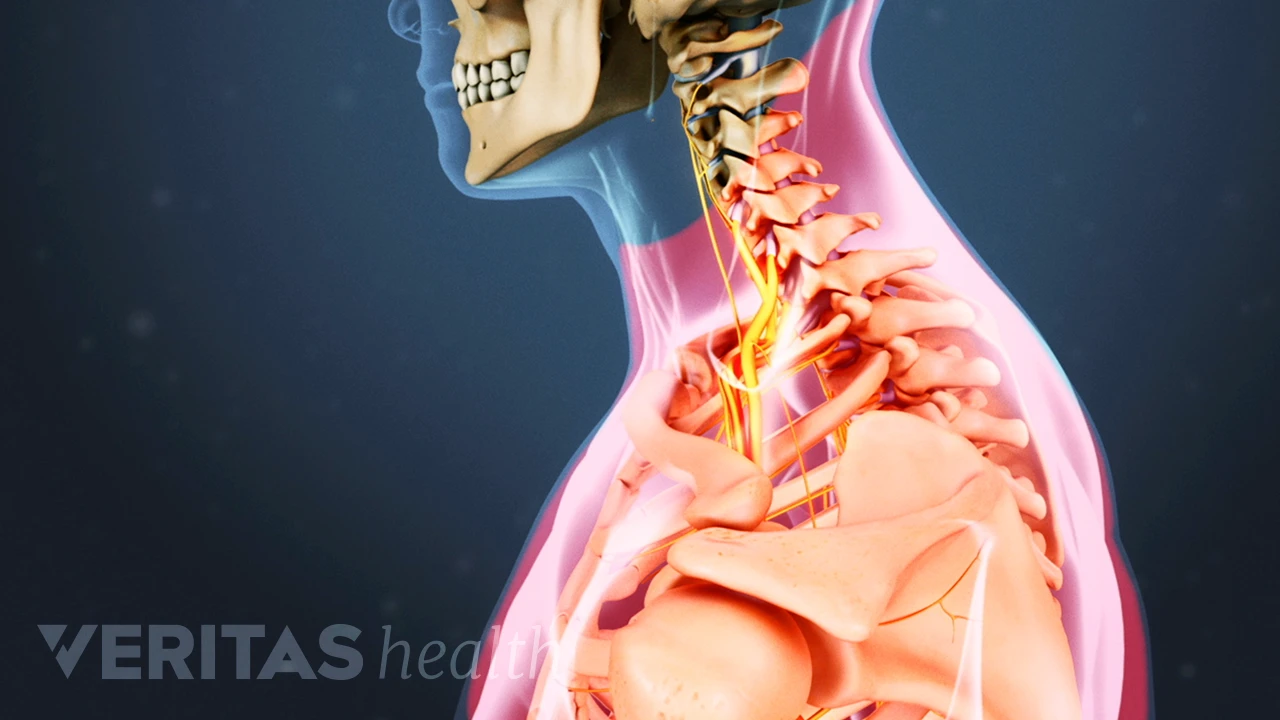 Understanding Neck And Shoulder Pain Spine-health