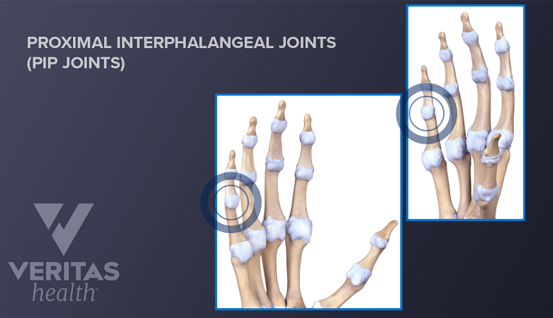 Illustration of PIP joint of the hand