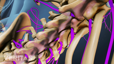 Medical illustration showing the lumbar nerve roots coming out of the spinal cord