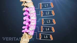Vista de perfil de la columna lumbar etiquetada L1, L2, L3, L4 y L5.
