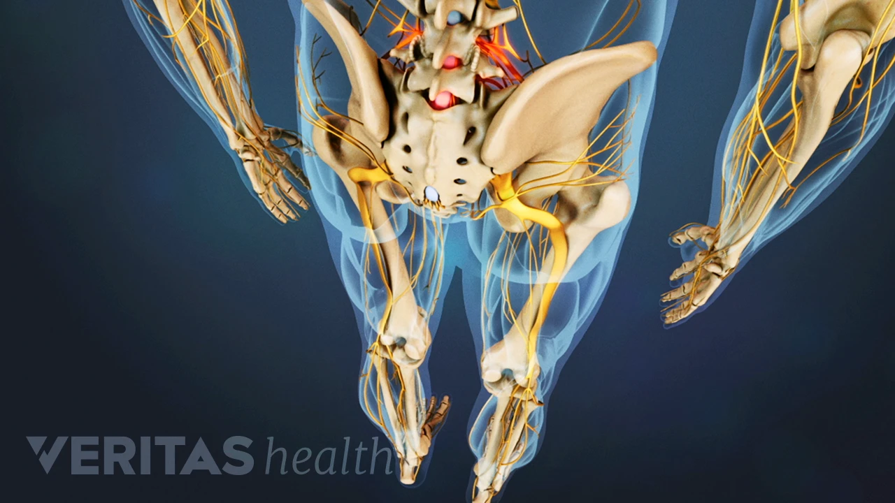 Axial Back Pain: Most Common Low Back Pain | Spine-health