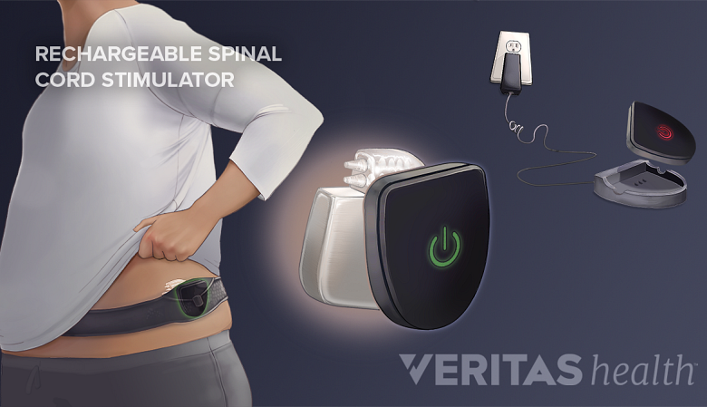 Rechargeable spinal cord stimulator charging belt for the lower back.